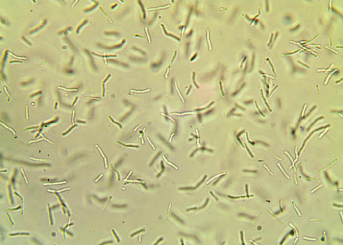 AKRA Straw R. + P + K AKRA Straw R. + P + K for a faster rotting